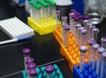 ​Laboratoř v jediném testu zjistí COVID-19 i dva typy chřipky
