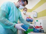 ​Laboratoř AGELLAB vyšetřila 50 000 vzorků a je připravena na druhou vlnu epidemie